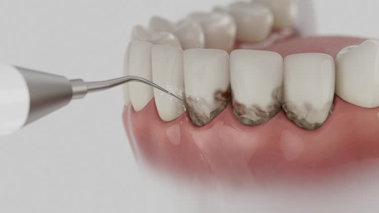 Reliable Tooth Extraction contractor in Lexington city County, VA by Dentist Open Now